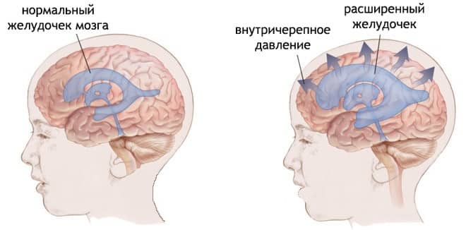Симптомы болезни Симптомы болезни