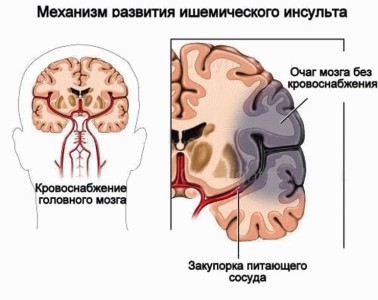 Наиболее известные патологии фото