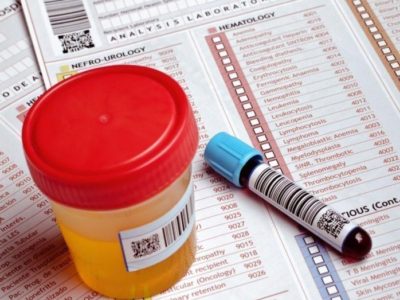 Необходимые мероприятия при оформлении Необходимые мероприятия при оформлении