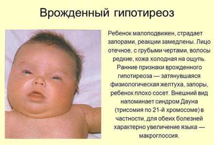 Симптомы наличия патологии