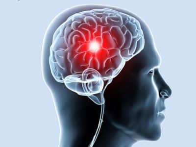 Этиология проблемы Этиология проблемы